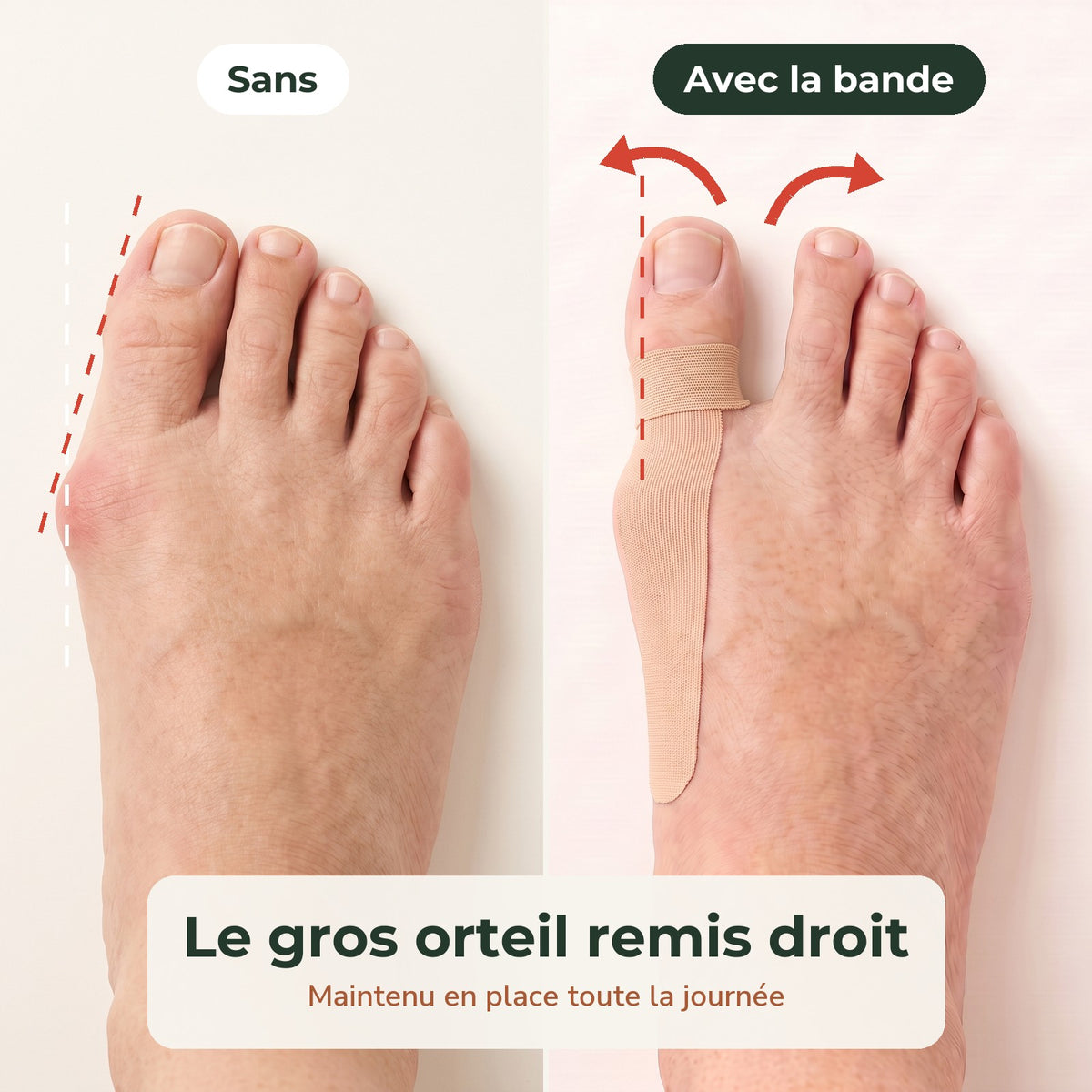 Sans et avec la bande : le gros orteil remis droit